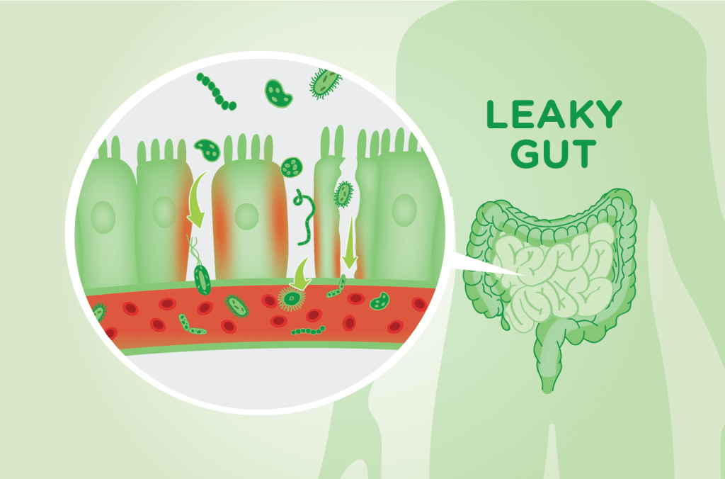 läckande tarm tarmrening P&b shake