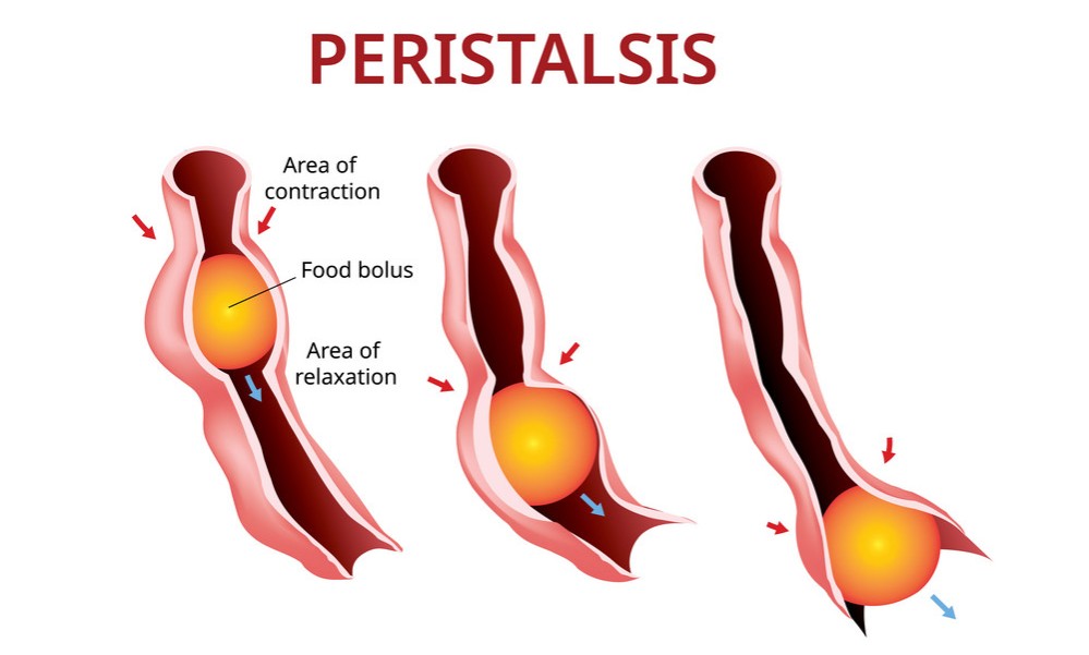 peristalsis för tarmplacket framåt tarmrening