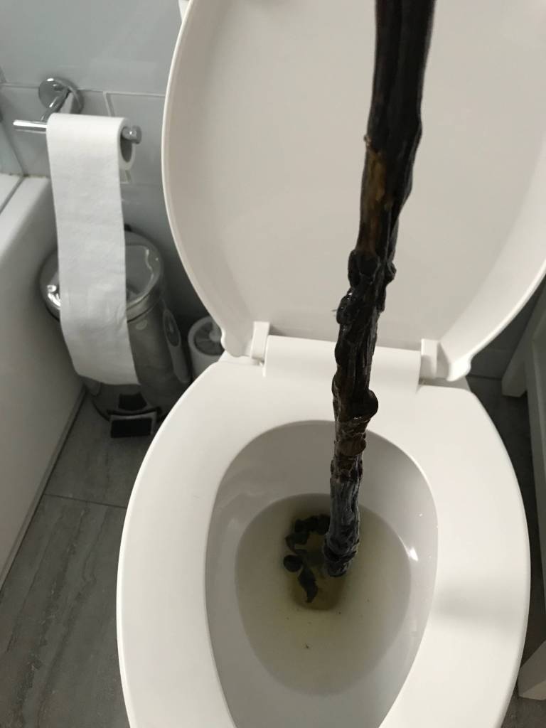 extremt långt svart tarmplack tarmrening tjej youtube