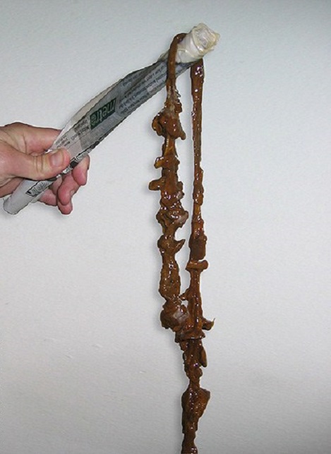 tarmplack tarmrening