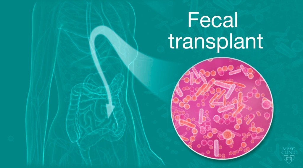 Fekal transplantation, animerad bild med grön bakgrund.