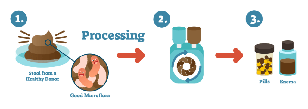 Tecknad bild för fekal transplantation. Processen bakom tillverkning av piller samt lavemang.